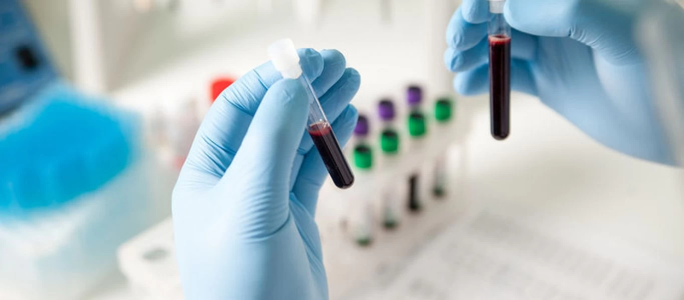 Επιστήμονες ανέπτυξαν τεστ αίματος που ανιχνεύει 50 τύπους καρκίνου πριν από την εμφάνιση ενδείξεων ή συμπτωμάτων